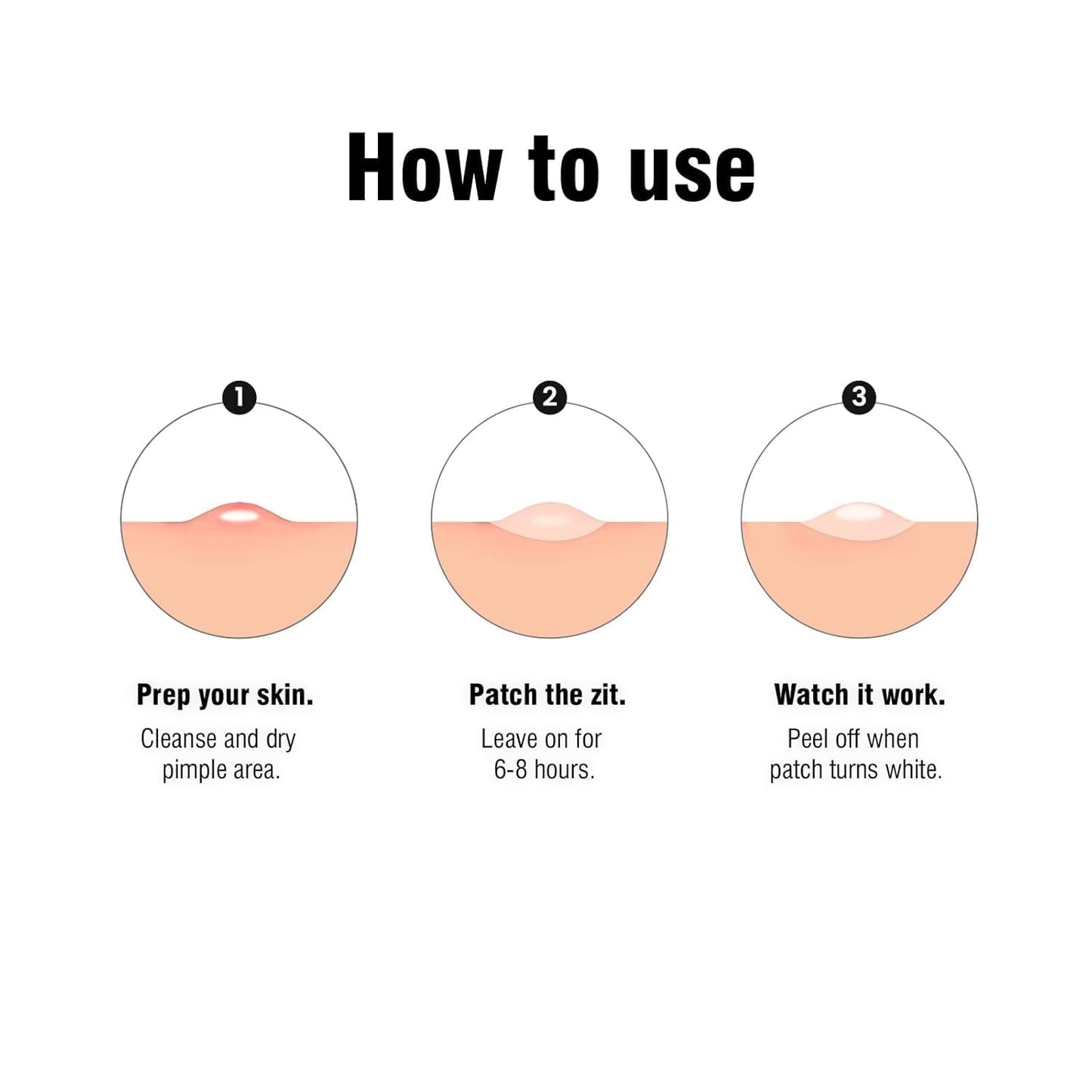 Pimple Patches For Face: Emergency Spot Patch Hydrocolloid Acne Pimple Patch for Covering Zits and Blemishes Spot Stickers for Face and Skin 36 Patches