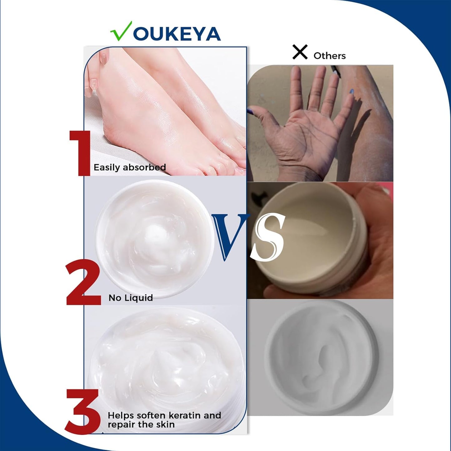 NEW FORMULA Urea Cream 40% Plus 2% Salicylic Acid for Feet Maximum Strength, Dry Cracked Hand Heel Moisturizing Repair Lotion for Knees, Elbows, Removes Corns, Dead Skin Cream, 5.29 oz