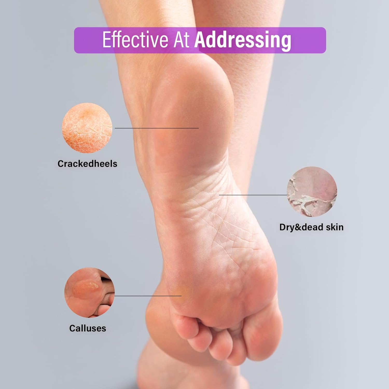 Foot Peeling Mask 3 Pairs: Peeling Foot Mask Dermatologically Tested, Heels &amp; Dry Dead Skin for Soft Feet, Foot Peel Mask (new Lavender)