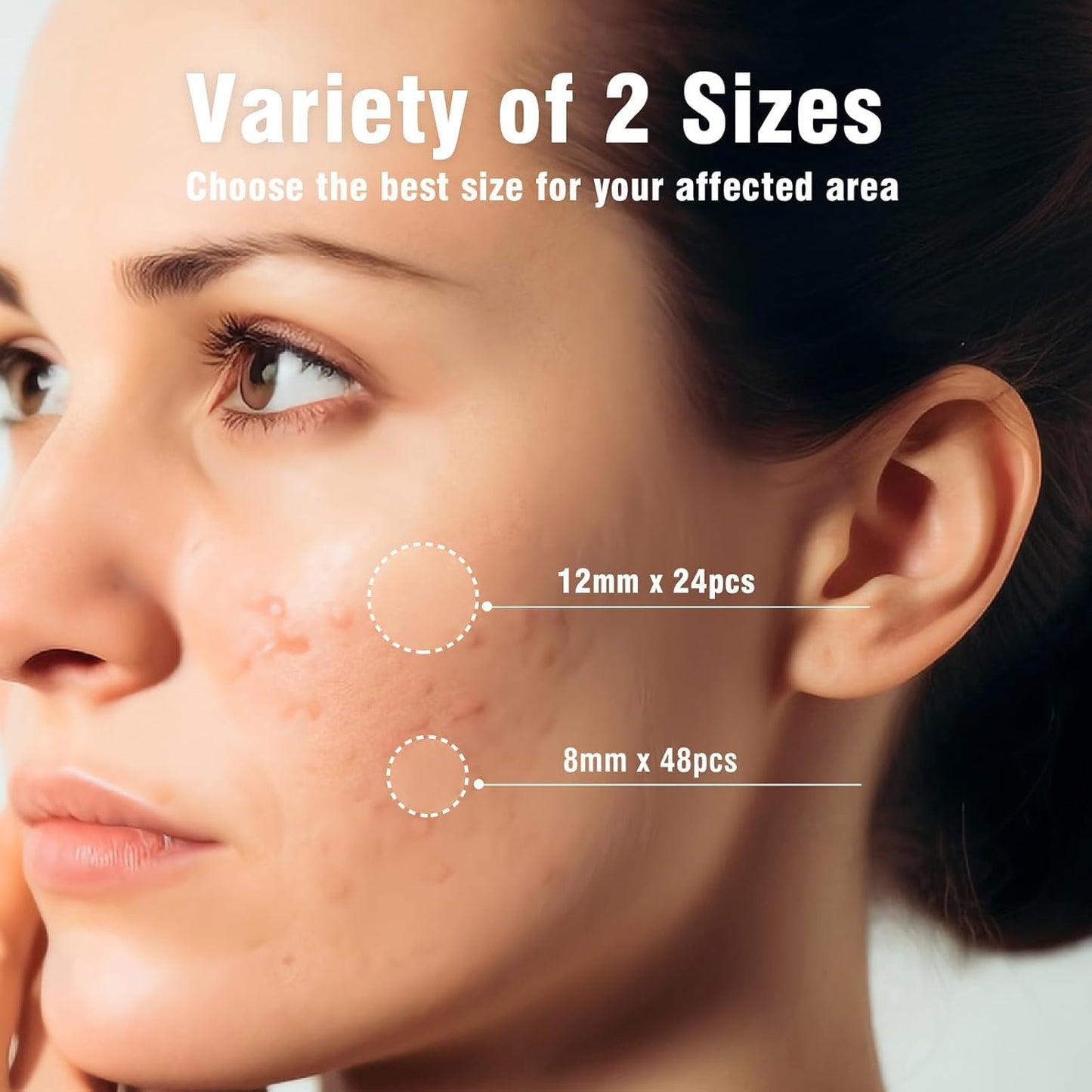 Pimple Patches For Face: Emergency Spot Patch Hydrocolloid Acne Pimple Patch for Covering Zits and Blemishes Spot Stickers for Face and Skin 36 Patches