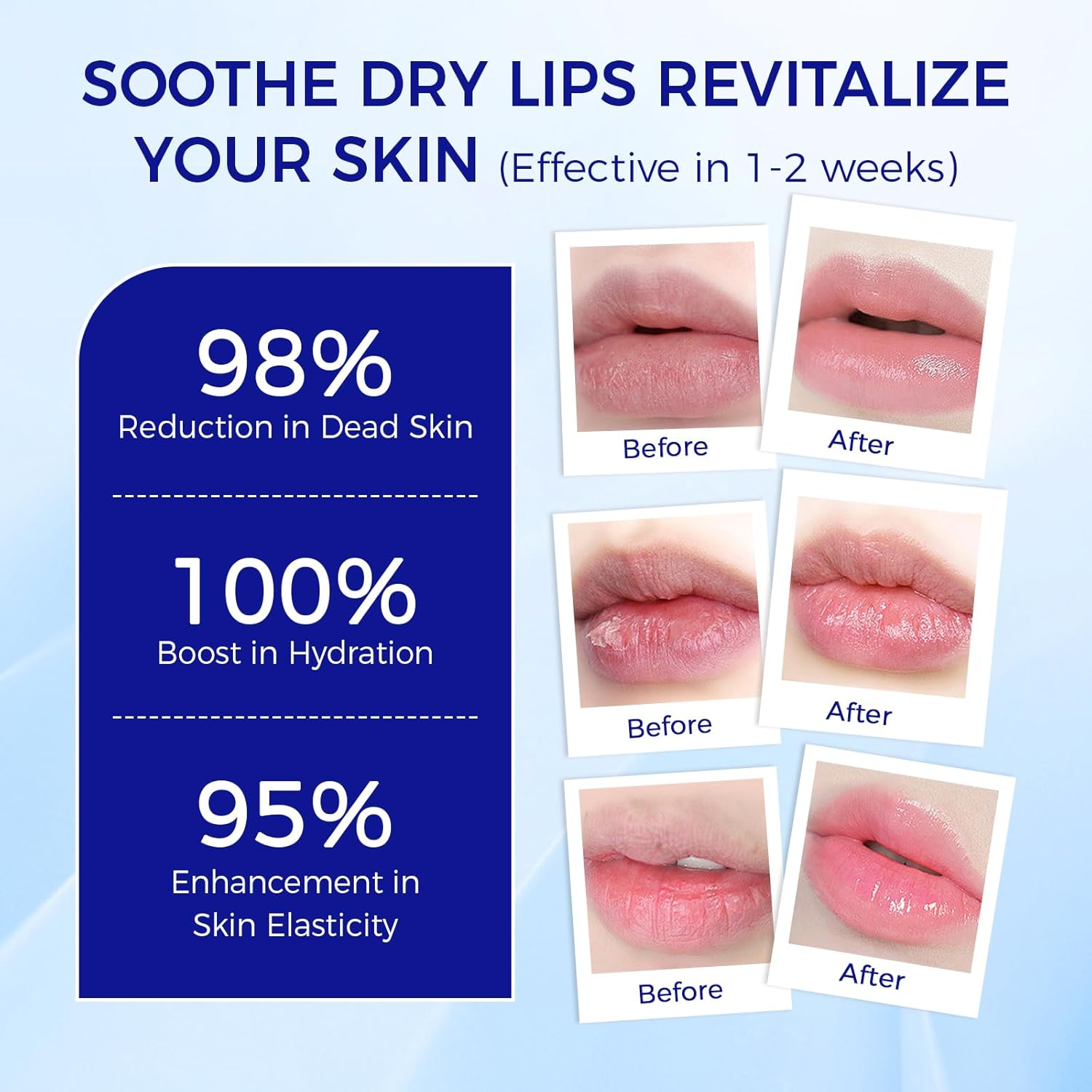 Medicated Lip Balm w/Organic &amp; 100% Natural Ingredients, Squeeze Tube Lip Butter SPF 25+ Long-Lasting Moisturizing Overnight Lip Mask Gentle Exfoliation Extreme Dry Lips Treatment