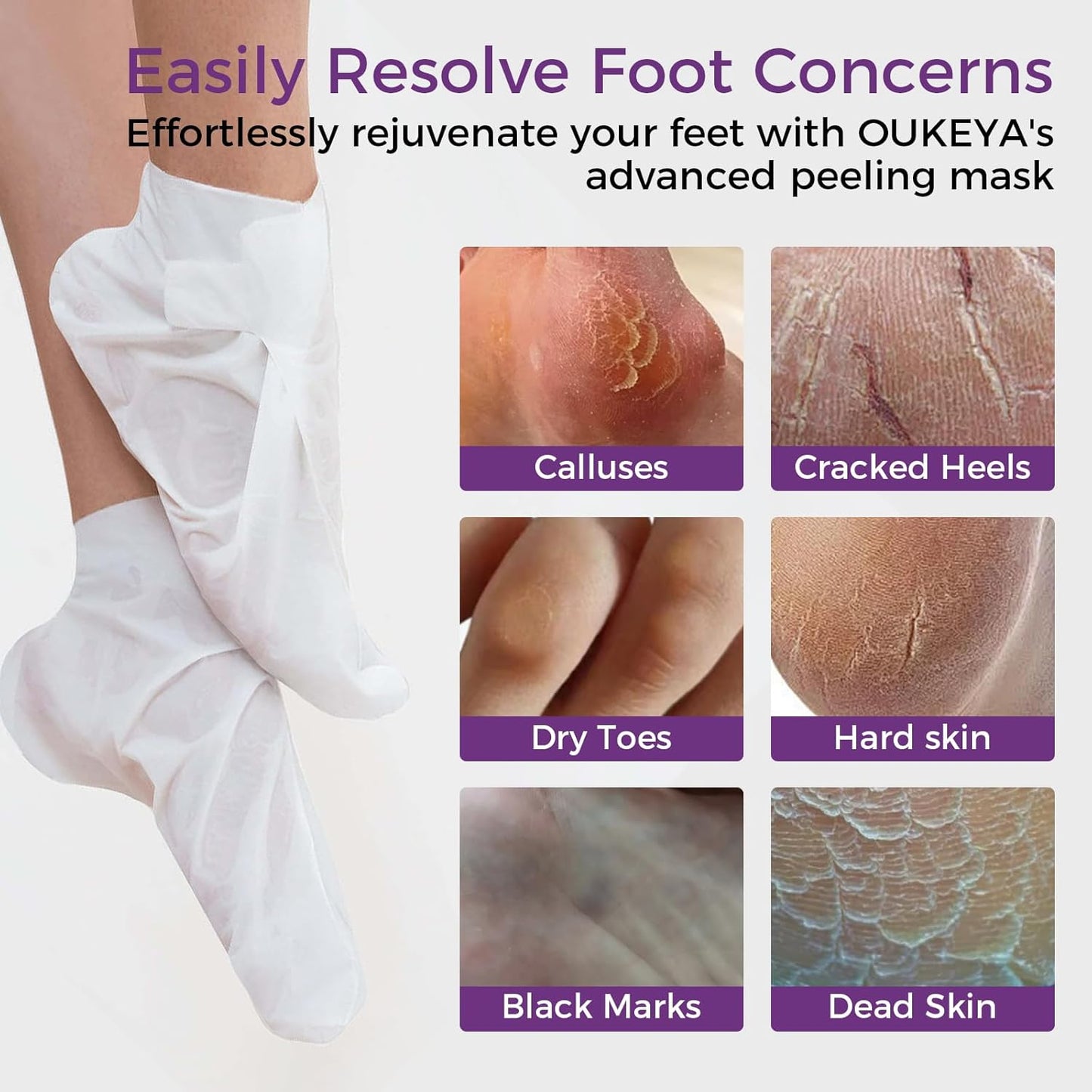 Foot Peeling Mask 3 Pairs: Peeling Foot Mask Dermatologically Tested Repairs Heels &amp; Removes Dry Dead Skin for Baby Soft Feet Exfoliating Foot Peel Mask for Dry Cracked Feet Athletes Foot Treatment