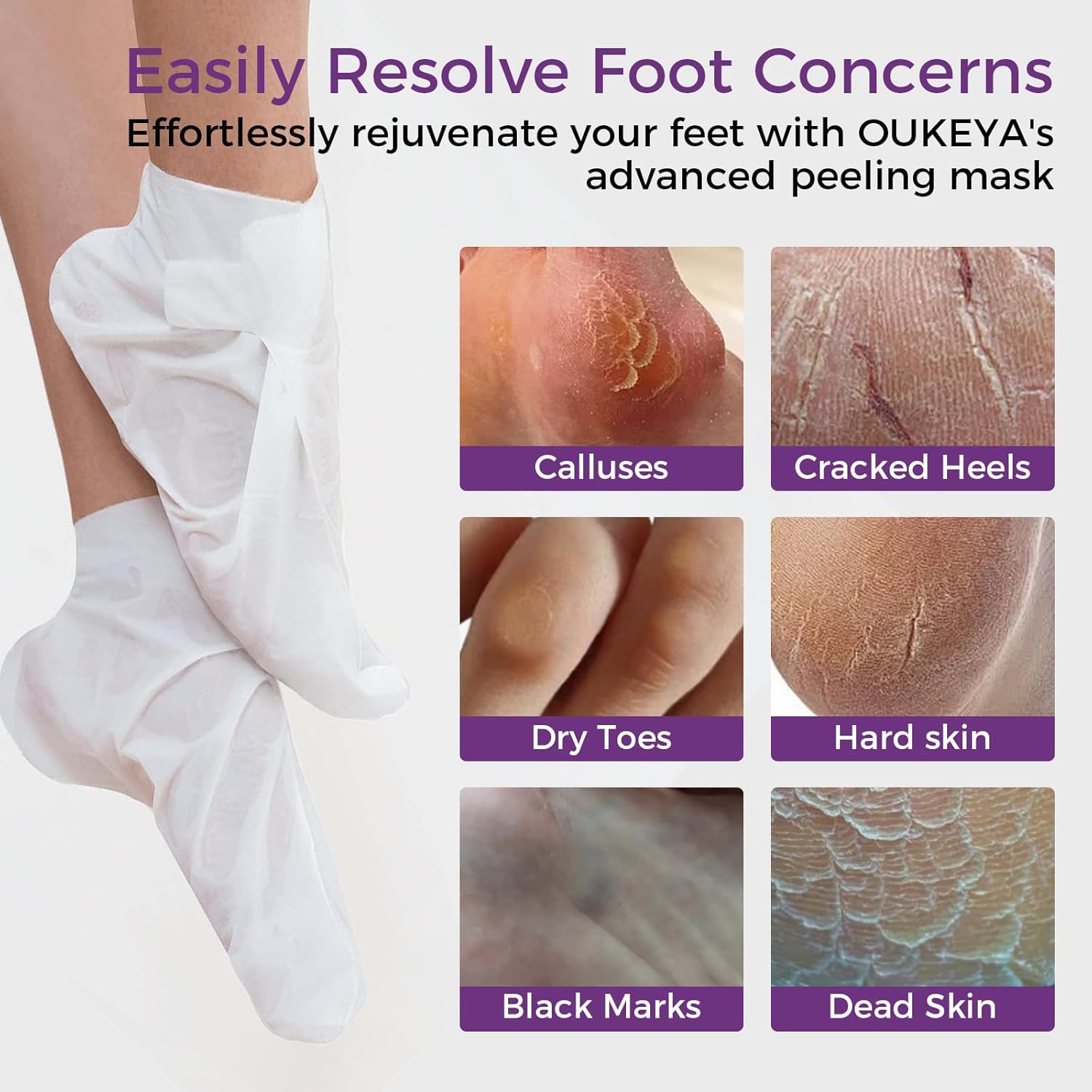 Foot Peeling Mask 3 Pairs: Peeling Foot Mask Dermatologically Tested Repairs Heels &amp; Removes Dry Dead Skin for Baby Soft Feet Exfoliating Foot Peel Mask for Dry Cracked Feet Athletes Foot Treatment