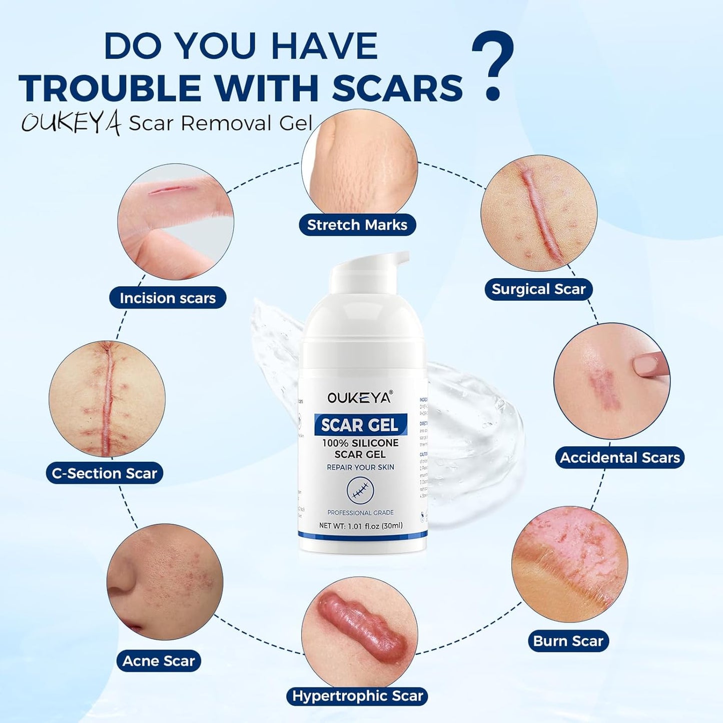 Silicone Scar Gel - 100% Silicone Cream Perfect for Sensitive Skin, Say Goodbye to Old and New Scars (30ml)