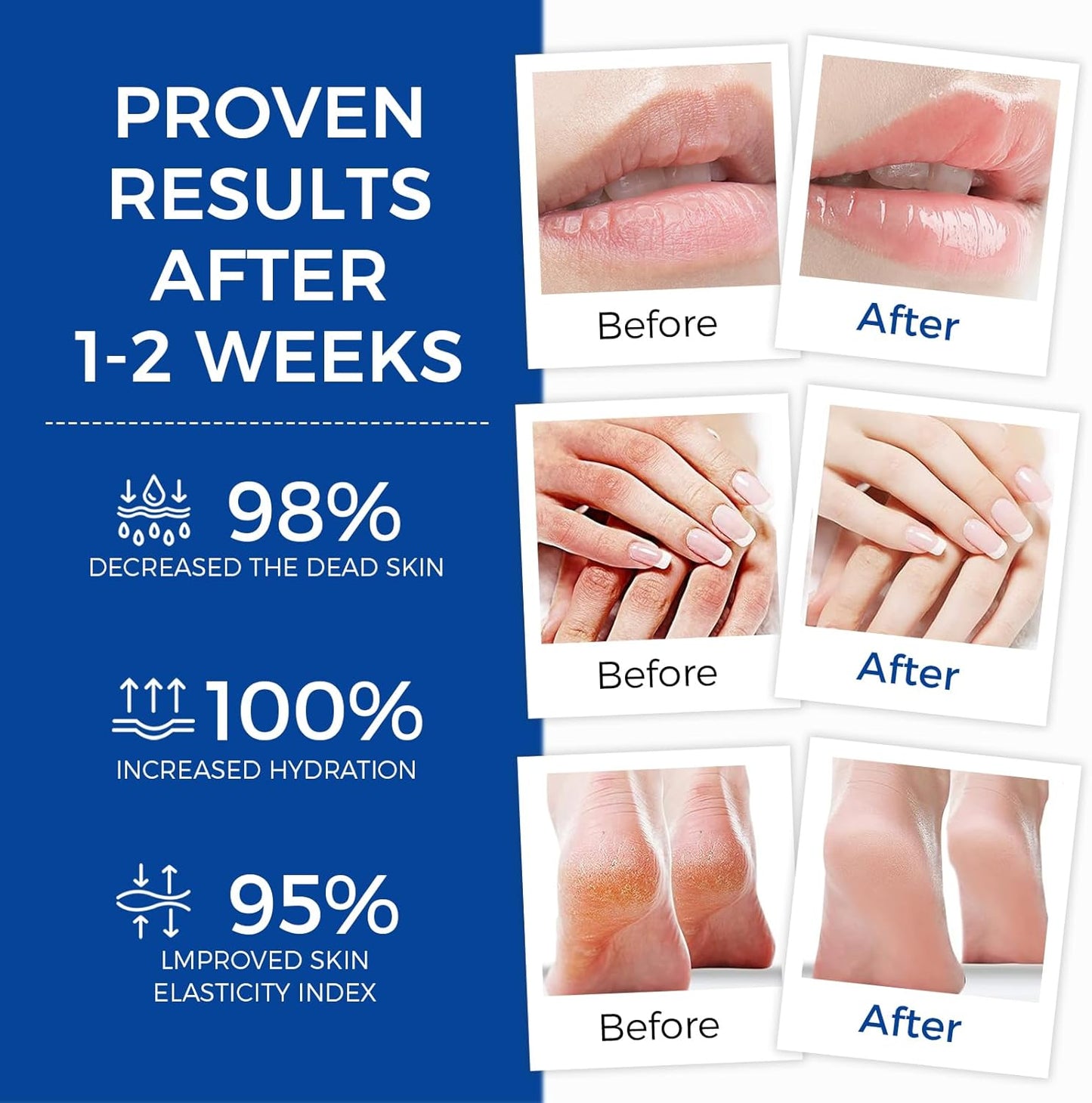 Healing Ointment, Advanced Therapy Skin Protectant, Multi-Purpose Healing Ointment and Body Moisturizer, For Dry, Cracked Skin, Minor Cuts and Burns, Soothes Cracked Hands and Chapped Lips