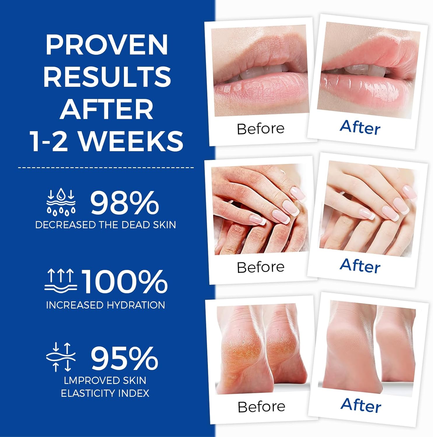 Healing Ointment, Advanced Therapy Skin Protectant, Multi-Purpose Healing Ointment and Body Moisturizer, For Dry, Cracked Skin, Minor Cuts and Burns, Soothes Cracked Hands and Chapped Lips