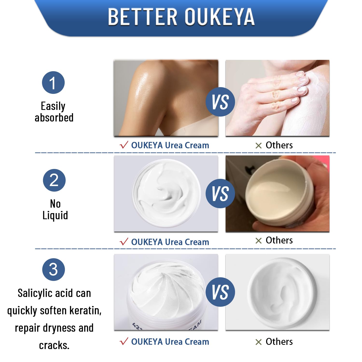 Urea Cream 42% plus Salicylic Acid 2% Net 5.29 Oz for Dry Cracked Feet,Heels,Knees,Elbows,Hands Repair Treatment Moisturizes and Removes Corns,Calluses,Dead Skin,and Softens Toenails