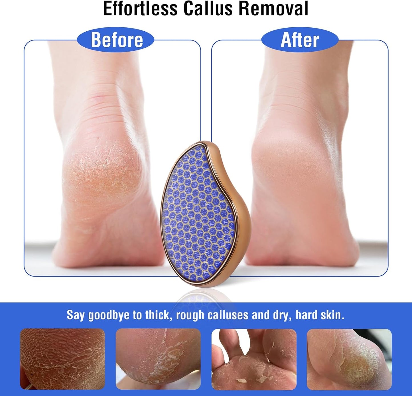 Glass Foot File Callus Remover: Nano Glass Heel Scraper for Feet Shower Foot Scrubber Pedicure Dead Skin Remover Shower Care Crystal Hair Remover Treat Hair Eraser for Back Arms Legs