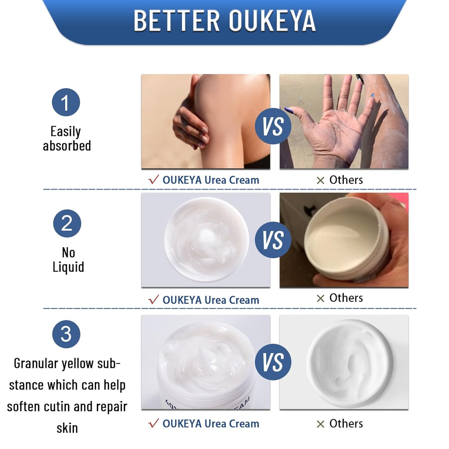Urea Cream 40 Percent,Foot &amp; Hand Cream for Dry Cracked,Urea Lotion for Feet Maximum Strength