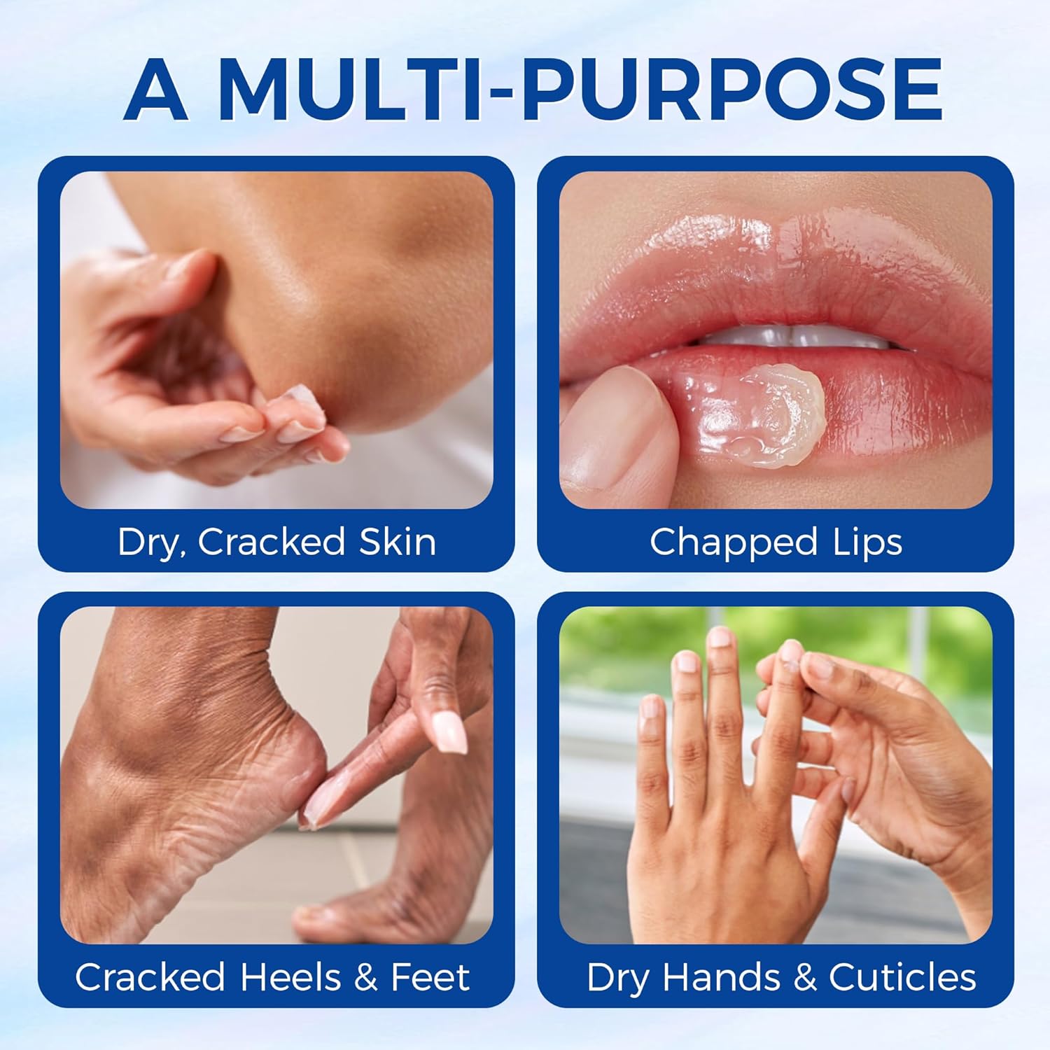 Healing Ointment, Advanced Therapy Skin Protectant, Multi-Purpose Healing Ointment and Body Moisturizer, For Dry, Cracked Skin, Minor Cuts and Burns, Soothes Cracked Hands and Chapped Lips